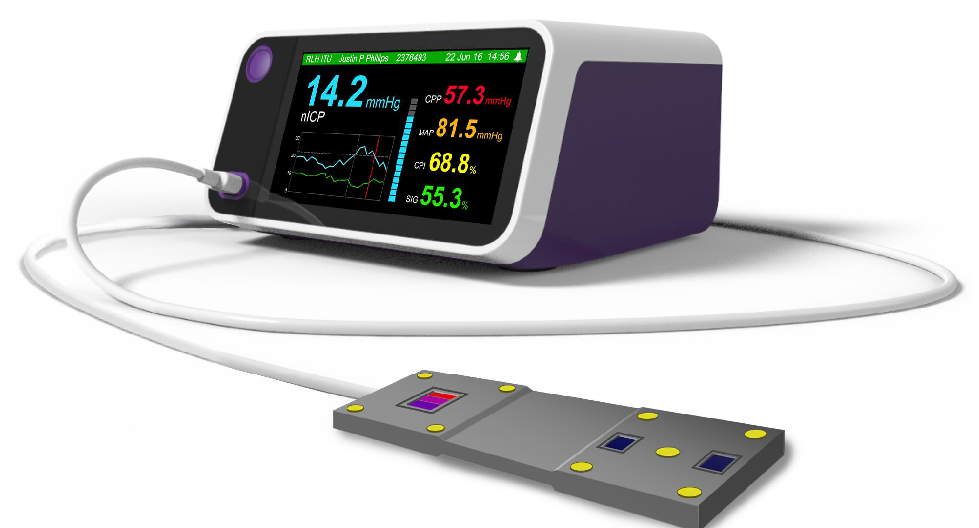 Девайс монитор. Монитор для измерения внутричерепного давления ICP-Monitor. Intracranial Pressure. Pressure monitoring. Зонд мониторинга.